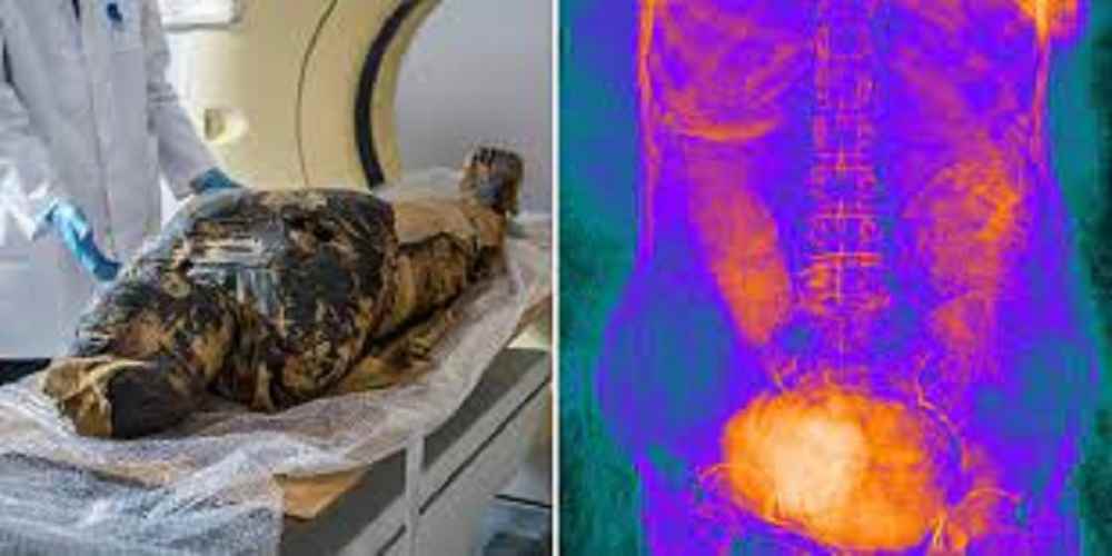 descoperirea unui fat mumificat in uterul unei mumii